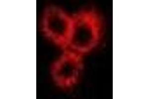 Immunofluorescent analysis of Neurokinin B staining in Hela cells.