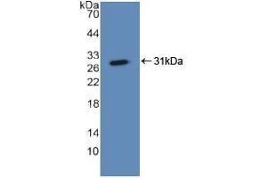 Detection of Recombinant ASGR1, Human using Polyclonal Antibody to Asialoglycoprotein Receptor 1 (ASGR1) (Asialoglycoprotein Receptor 1 anticorps  (AA 77-289))