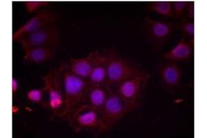 Image no. 2 for anti-Estrogen Receptor 1 (ESR1) (pSer118) antibody (ABIN196743) (Estrogen Receptor alpha anticorps  (pSer118))