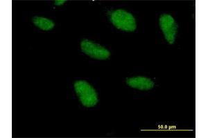 Immunofluorescence of purified MaxPab antibody to SAP18 on HeLa cell. (SAP18 anticorps  (AA 1-153))