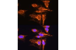 Immunofluorescence analysis of C6 cells using  Rabbit pAb (ABIN1678653, ABIN5664340, ABIN5664342 and ABIN6220284) at dilution of 1:100. (AMPD1 anticorps  (AA 50-260))