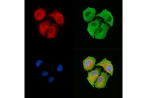 ABIN6263377 and ABIN6278723 staining  cells by IF/ICC. (MRPS11 anticorps  (C-Term))
