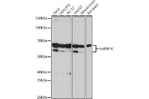 Western blot analysis of extracts of various cell lines, using hnRNP K antibody (ABIN7267634) at 1:2000 dilution. (HNRNPK anticorps)