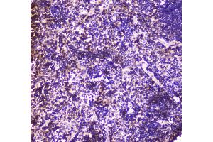 IHC analysis of Annexin VI using anti-Annexin VI antibody .