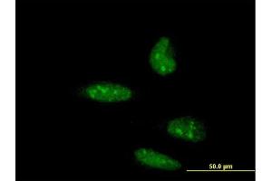Immunofluorescence of monoclonal antibody to ATOH1 on HeLa cell. (ATOH1 anticorps  (AA 266-354))