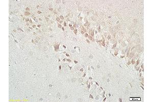 Formalin-fixed and paraffin embedded: rat brain tissue labeled with Anti-GABRB1 Polyclonal Antibody (ABIN669756), Unconjugated at 1:200 followed by conjugation to the secondary antibody and DAB staining (GABBR1 anticorps  (AA 651-750))