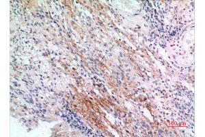 Immunohistochemistry (IHC) analysis of paraffin-embedded Human Brain, antibody was diluted at 1:100. (IFITM1 anticorps  (N-Term))