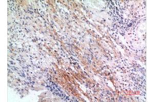 Immunohistochemistry (IHC) analysis of paraffin-embedded Human Brain, antibody was diluted at 1:100. (IFITM1 anticorps  (N-Term))