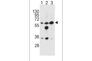 GATM Antibody (N-term) (ABIN654401 and ABIN2844143) western blot analysis in HL-60(lane 1),MDA-M(lane 2),K562(lane 3) cell line lysates (35 μg/lane). (GATM anticorps  (N-Term))