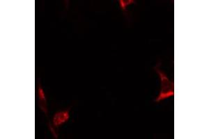 ABIN6267637 staining HepG2 by IF/ICC.