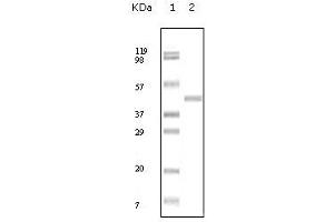 Western Blot showing ABL2 antibody used against truncated ABL2 recombinant protein. (ABL2 anticorps)