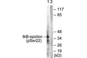 Western blot analysis of extracts from Jurkat cells treated with TNF-a 20ng/ml 30', using IkappaB-epsilon (Phospho-Ser22) Antibody. (IkappaB-epsilon anticorps  (pSer22))