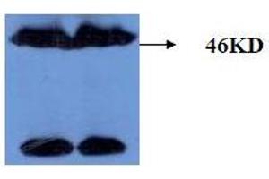 Western Blotting (WB) image for anti-Microtubule-Associated Protein tau (MAPT) (AA 177-187), (pThr181) antibody (ABIN1108153) (MAPT anticorps  (pThr181))