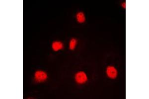 Immunofluorescent analysis of GATA1 staining in K562 cells. (GATA1 anticorps  (Center))