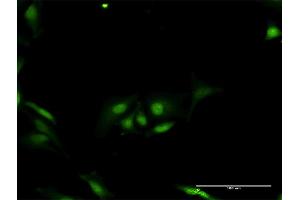 Immunofluorescence of purified MaxPab antibody to ORC6L on HeLa cell. (ORC6 anticorps  (AA 1-252))