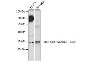 anti-Tryptase beta 2 (TPSB2) (AA 1-275) antibody