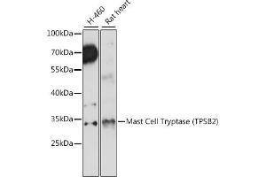 Western blot analysis of extracts of various cell lines, using Mast Cell Tryptase (Mast Cell Tryptase (TPSB2)) antibody (ABIN7271018) at 1:1000 dilution. (TPSB2 anticorps  (AA 1-275))
