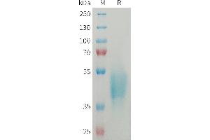 Human OSCAR Protein, His Tag on SDS-PAGE under reducing condition.