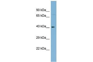 WB Suggested Anti-C1orf92 Antibody Titration: 0. (C1orf92 anticorps  (Middle Region))