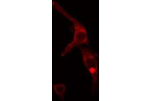 ABIN6272441 staining MCF7 cells by IF/ICC. (TBL2 anticorps  (C-Term))