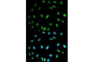 Immunofluorescence (IF) image for anti-Selenium Binding Protein 1 (SELENBP1) (AA 243-472) antibody (ABIN3021767)
