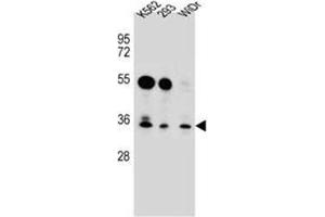 Western blot analysis of GLIPR1L2 Antibody (N-term) in K562,293,WiDr cell line lysates (35ug/lane). (GLIPR1L2 anticorps  (N-Term))
