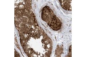 Immunohistochemical staining of human testis with DHX36 polyclonal antibody  shows strong nuclear and cytoplasmic positivity in cells of seminiferus ducts at 1:20-1:50 dilution. (DHX36 anticorps)