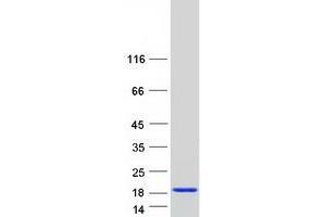Validation with Western Blot
