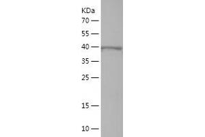 Western Blotting (WB) image for Interleukin 17 Receptor B (IL17RB) (AA 317-494) protein (His-IF2DI Tag) (ABIN7123554)