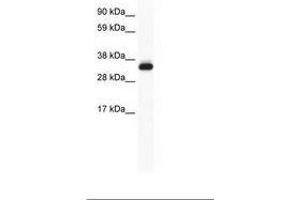 Image no. 1 for anti-Annexin A5 (ANXA5) (AA 93-142) antibody (ABIN202232)