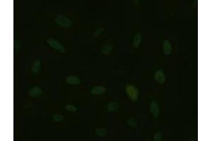 Immunofluorescent staining of HeLa cells using anti-HNF6 mouse monoclonal antibody (ABIN2452681). (ONECUT1 anticorps  (AA 85-198))