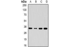 Western blot analysis of AKR7A3 expression in HepG2 (A), HT29 (B), mouse kidney (C), mouse liver (D) whole cell lysates. (AKR7A3 anticorps)