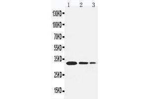 Lane 3: Recombinant Human TRAF1 Protein 1. (TRAF1 anticorps  (Middle Region))