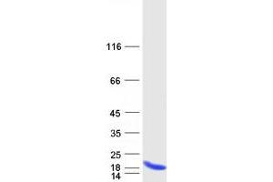 Validation with Western Blot