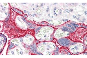 Detection of CCK in Human Placenta Tissue using Polyclonal Antibody to Cholecystokinin (CCK) (Cholecystokinin anticorps  (AA 1-115))