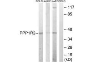 Western blot analysis of extracts from HuvEc/HepG2/COLO cells, using PPP1R2 (Ab-44) Antibody. (PPP1R2 anticorps  (AA 10-59))