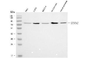 Western blot analysis of HRD1/SYVN1 using anti-HRD1/SYVN1 antibody (ABIN7602291). (SYVN1 anticorps  (AA 68-604))