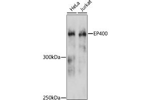 Western blot analysis of extracts of various cell lines, using EP400 antibody (ABIN6127822, ABIN6140195, ABIN6140196 and ABIN6215738) at 1:3000 dilution. (EP400 anticorps  (AA 90-330))
