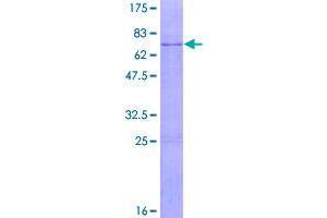 Image no. 1 for Suppressor of Variegation 3-9 Homolog 2 (Drosophila) (SUV39H2) (AA 1-350) protein (GST tag) (ABIN1321939)