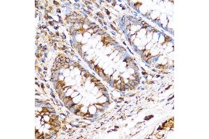 Immunohistochemistry of paraffin-embedded Human colon using PDXP Rabbit pAb (ABIN7269758) at dilution of 1:100 (40x lens).