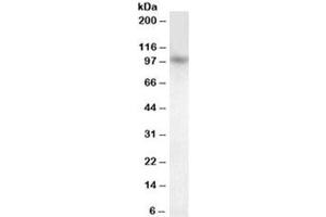 Western blot testing of human cerebellum lysate with PRDM1 antibody at 1ug/ml. (PRDM1 anticorps)