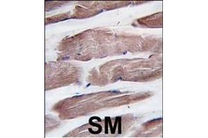 Formalin-fixed and paraffin-embedded human skeletal muscle tissue reacted with hPI3KC3 (N-term) (ABIN1882112 and ABIN2849998) , which was peroxidase-conjugated to the secondary antibody, followed by DAB staining. (PIK3C3 anticorps  (N-Term))