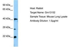 Image no. 1 for anti-Zinc Finger Protein 982 (Zfp982) (N-Term) antibody (ABIN6749822) (Zfp982 anticorps  (N-Term))
