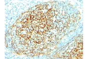 Formalin-fixed, paraffin-embedded human Tonsil stained with CD106 Monoclonal Antibody (1. (VCAM1 anticorps)