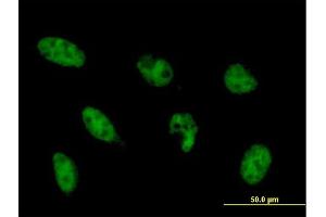 Immunofluorescence of monoclonal antibody to NFYB on HeLa cell. (NFYB anticorps  (AA 1-207))