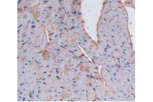 IHC-P analysis of Mouse Heart Tissue, with DAB staining. (Albumin anticorps)