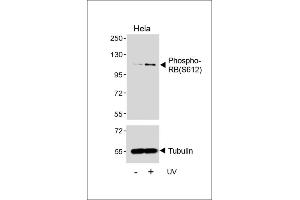Western blot analysis of lysates from Hela cell line, untreated or treated with UV(2h), using Phospho-RB Antibody (upper) or Tubulin (lower). (Retinoblastoma 1 anticorps  (pSer612))