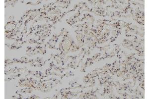 ABIN6273570 at 1/100 staining Human lung tissue by IHC-P.
