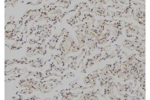 ABIN6273570 at 1/100 staining Human lung tissue by IHC-P. (SNAPC3 anticorps  (C-Term))
