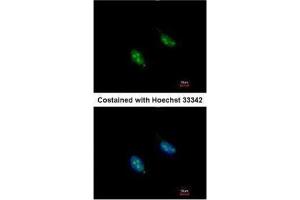 ICC/IF Image Immunofluorescence analysis of paraformaldehyde-fixed HeLa, using RFC3, antibody at 1:200 dilution. (RFC3 anticorps)